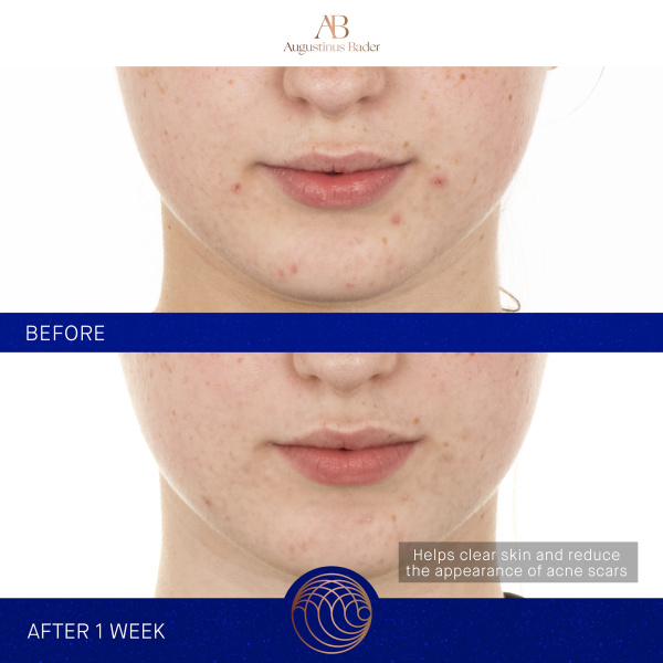 Augustinus Bader The Retinol Serum 15 ml.