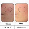 Advanced Nutrition Programme Skin Clear Biome™ 60