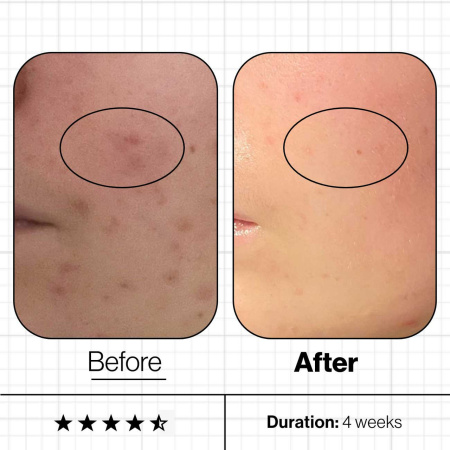Advanced Nutrition Programme Skin Clear Biome™ 60