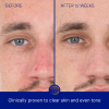 Augustinus Bader The Retinol Serum 50 ml.