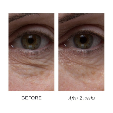 ELEMIS Peptide4 Eye Recovery Cream