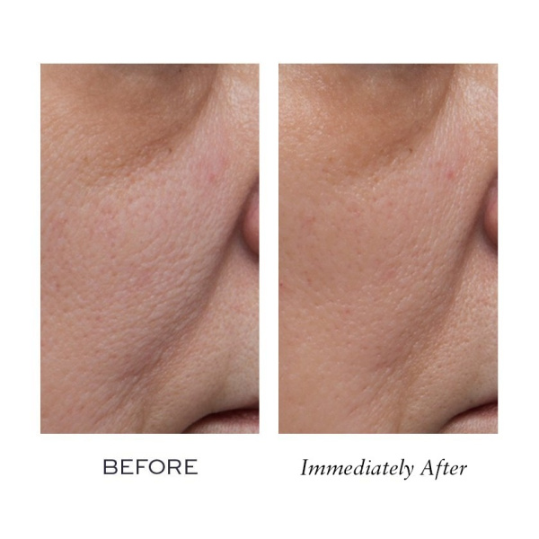 ELEMIS Peptide4 Thousand Flower Mask