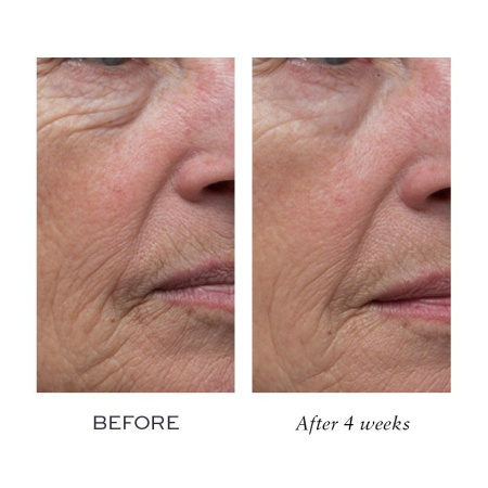ELEMIS Pro-Definition Day Cream