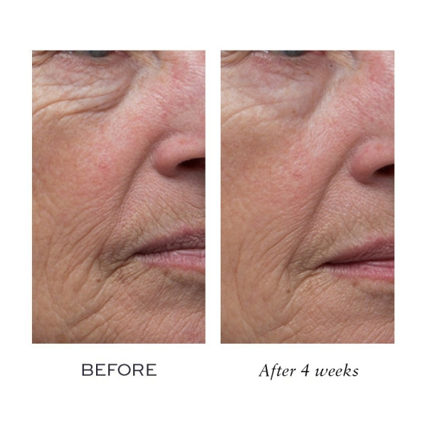ELEMIS Pro-Definition Day Cream