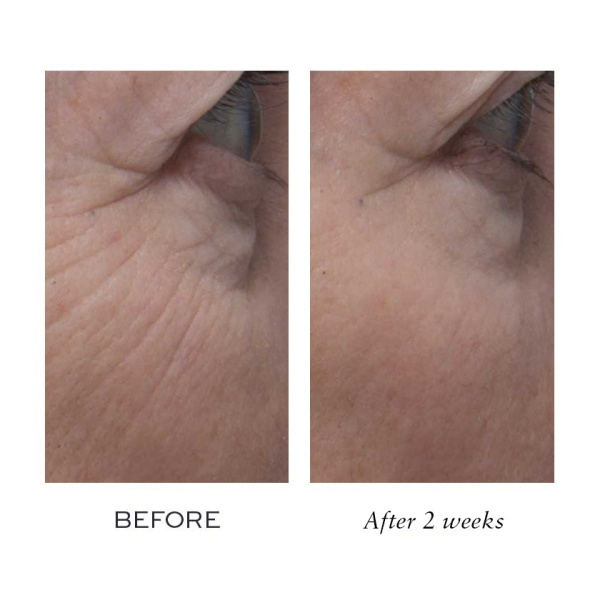 ELEMIS Peptide4 Night Recovery Cream-Oil
