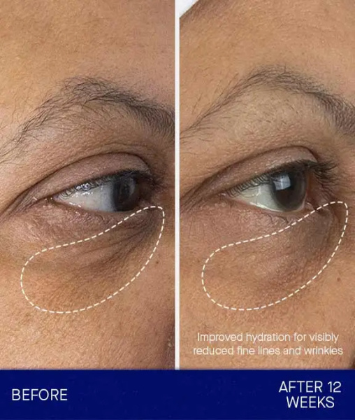 Augustinus Bader The Eye Cream Nomad (refill)